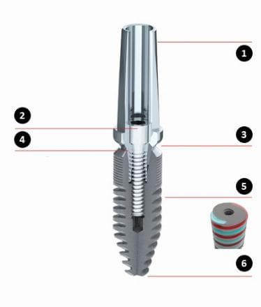 Inserimento dell'impianto Evoss