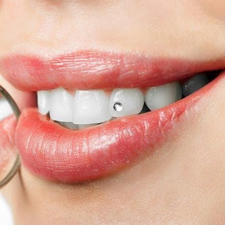 Rivestimento denti in zirconio