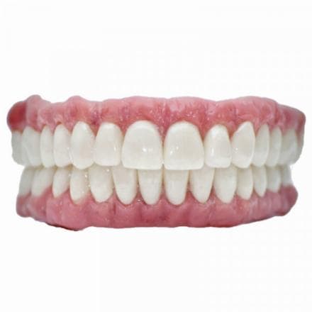 Corona in zirconio-ceramica su impianto