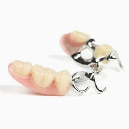 Protesi parziale Wironit