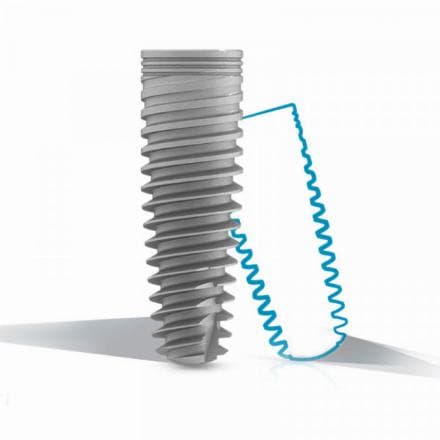 Inserimento degli impianti MIS 1