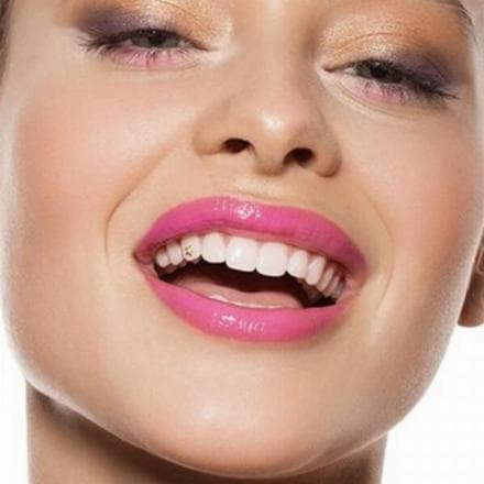 Gioielli per i denti