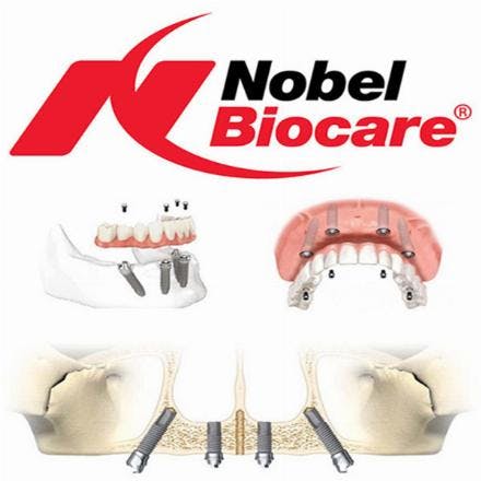 Nobel Biocare implant insertion